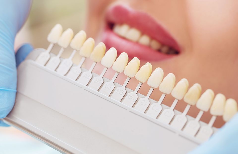 Get a sparkling smile with Teeth Whitening Process