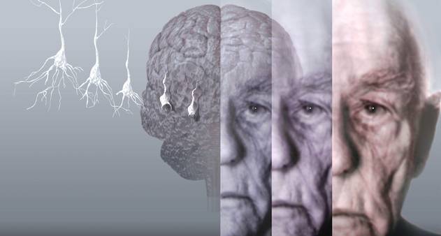 6 Conditions That Are Connected With Alzheimer’s Disease